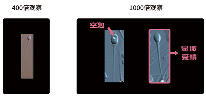 IMSI显微受精技术